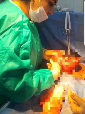 Female surgeon in green scrubs and mask performing a surgical procedure in an operation theater.